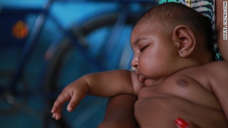 Zika virus linked to birth defect in newborns