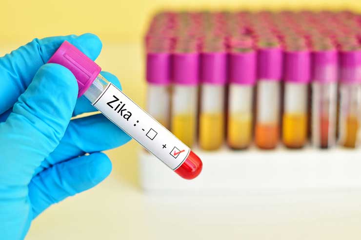 Zika-virus-positive-740