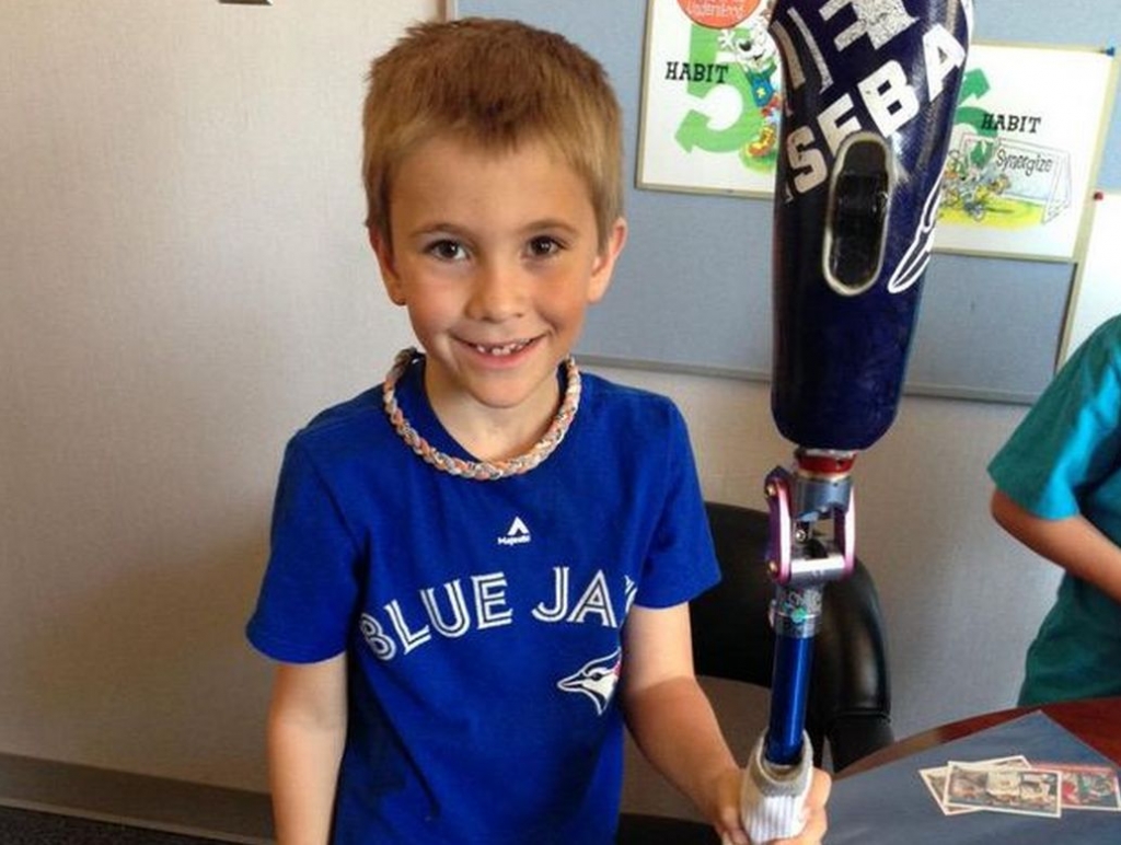 Roan Heck shows off his prosthetic leg that the Blue Jays signed earlier this season