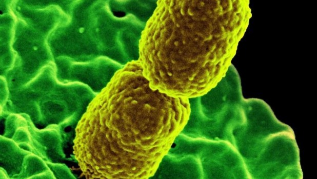 Two carbapenem-resistant Klebsiella pneumonias bacteria part of the family of germs known as Enterobacteriaceae