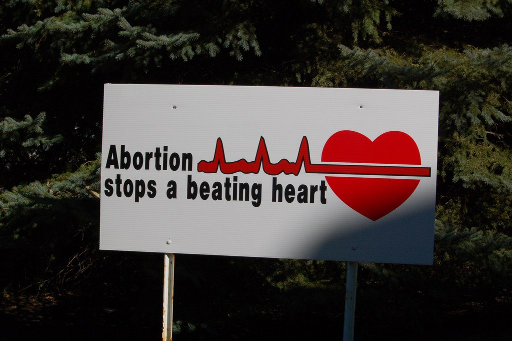 Pro-life sign at St. John’s Catholic Church in Onawa