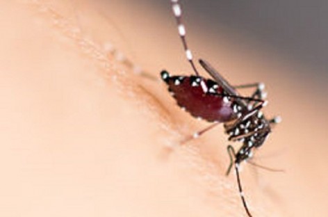 Sexually-transmitted Zika case confirmed in Texas