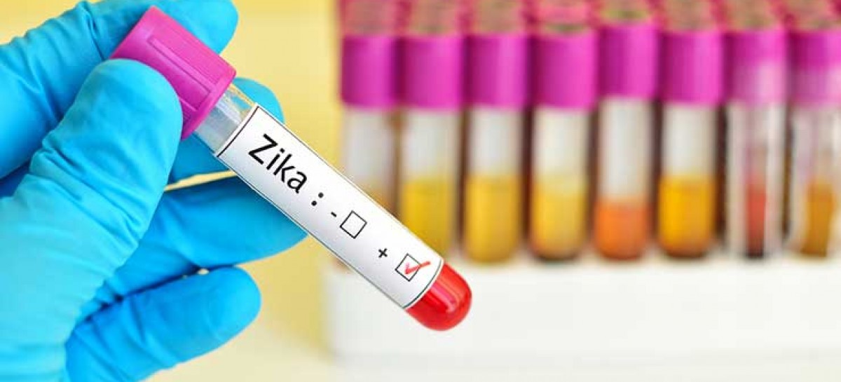 Public health emergency declared in 4 Fla. counties for Zika virus