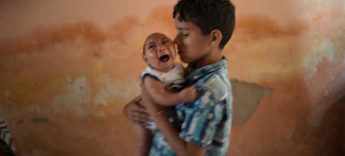 Zika birth defect may only become clear months after birth