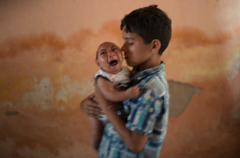 Zika birth defect may only become clear months after birth